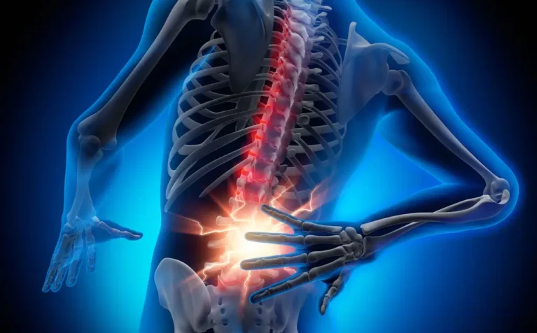 Rueckenschmerzen-verhindern-1024x1024